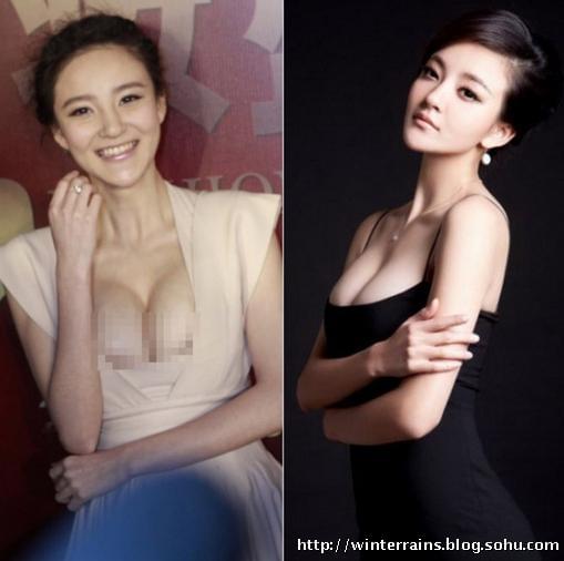 明星隆胸背后的審美趨勢與個人立場探討