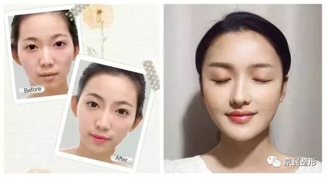 最新眉部美容技術，塑造完美眉型，瞬間驚艷全場的美顏秘訣 ???