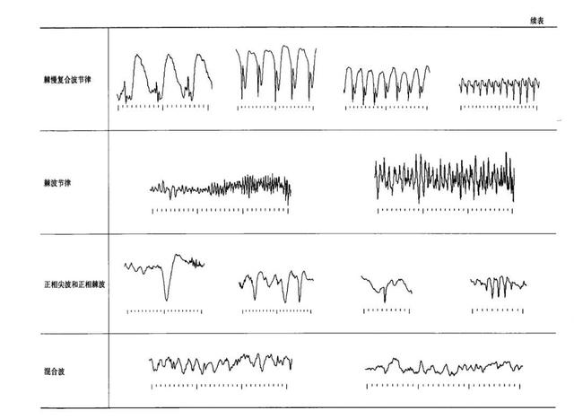 視頻腦電圖之旅，愛與陪伴的溫馨故事探尋價格揭秘