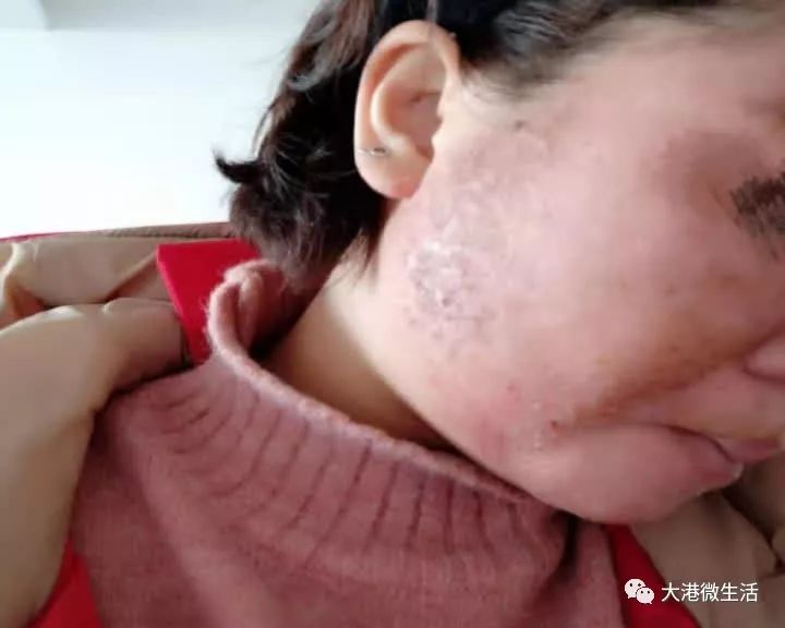 最新寶顏術(shù)，探索美容新境界的奧秘